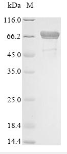 SDS-PAGE- Recombinant protein Escherichia dnaK