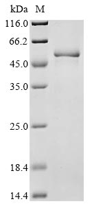 (Tris-Glycine gel) Discontinuous SDS-PAGE (reduced) with 5% enrichment gel and 15% separation gel. (Tris-Glycine gel) Discontinuous SDS-PAGE (reduced) with 5% enrichment gel and 15% separation gel.