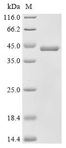 Recombinant Solanum tuberosum Patatin-15 - image 1