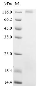 Recombinant Bovine Seizure 6-like protein 2 (SEZ6L2) , partial - image 1