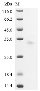 (Tris-Glycine gel) Discontinuous SDS-PAGE (reduced) with 5% enrichment gel and 15% separation gel. (Tris-Glycine gel) Discontinuous SDS-PAGE (reduced) with 5% enrichment gel and 15% separation gel.