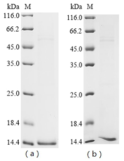 (Tris-Glycine gel) Discontinuous SDS-PAGE (reduced) with 5% enrichment gel and 15% separation gel. (Tris-Glycine gel) Discontinuous SDS-PAGE (reduced) with 5% enrichment gel and 15% separation gel.