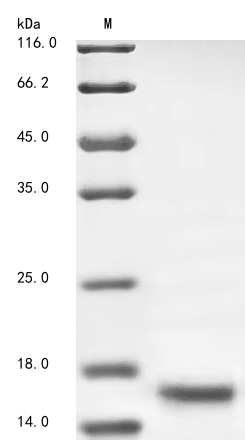 (Tris-Glycine gel) Discontinuous SDS-PAGE (reduced) with 5% enrichment gel and 15% separation gel. (Tris-Glycine gel) Discontinuous SDS-PAGE (reduced) with 5% enrichment gel and 15% separation gel.