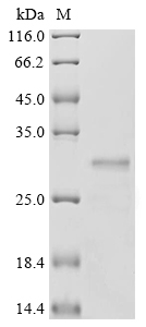(Tris-Glycine gel) Discontinuous SDS-PAGE (reduced) with 5% enrichment gel and 15% separation gel. (Tris-Glycine gel) Discontinuous SDS-PAGE (reduced) with 5% enrichment gel and 15% separation gel.