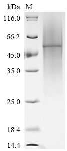 (Tris-Glycine gel) Discontinuous SDS-PAGE (reduced) with 5% enrichment gel and 15% separation gel. (Tris-Glycine gel) Discontinuous SDS-PAGE (reduced) with 5% enrichment gel and 15% separation gel.