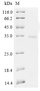 Recombinant Rat Meteorin-like protein (Metrnl) - image 1