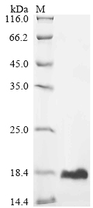 (Tris-Glycine gel) Discontinuous SDS-PAGE (reduced) with 5% enrichment gel and 15% separation gel. (Tris-Glycine gel) Discontinuous SDS-PAGE (reduced) with 5% enrichment gel and 15% separation gel.