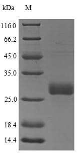 (Tris-Glycine gel) Discontinuous SDS-PAGE (reduced) with 5% enrichment gel and 15% separation gel. (Tris-Glycine gel) Discontinuous SDS-PAGE (reduced) with 5% enrichment gel and 15% separation gel.