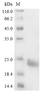 (Tris-Glycine gel) Discontinuous SDS-PAGE (reduced) with 5% enrichment gel and 15% separation gel. (Tris-Glycine gel) Discontinuous SDS-PAGE (reduced) with 5% enrichment gel and 15% separation gel.