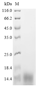 Recombinant Rat Vesicular glutamate transporter 1 (Slc17a7) , partial - image 1