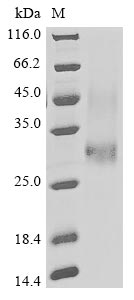 (Tris-Glycine gel) Discontinuous SDS-PAGE (reduced) with 5% enrichment gel and 15% separation gel. (Tris-Glycine gel) Discontinuous SDS-PAGE (reduced) with 5% enrichment gel and 15% separation gel.