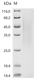 Recombinant Human Zinc finger CCCH domain-containing protein 14 (ZC3H14) - image 1