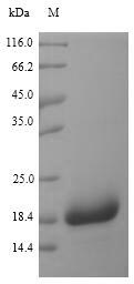 (Tris-Glycine gel) Discontinuous SDS-PAGE (reduced) with 5% enrichment gel and 15% separation gel. (Tris-Glycine gel) Discontinuous SDS-PAGE (reduced) with 5% enrichment gel and 15% separation gel.