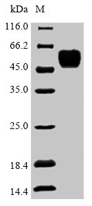 (Tris-Glycine gel) Discontinuous SDS-PAGE (reduced) with 5% enrichment gel and 15% separation gel. (Tris-Glycine gel) Discontinuous SDS-PAGE (reduced) with 5% enrichment gel and 15% separation gel.