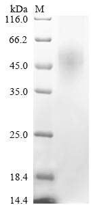 (Tris-Glycine gel) Discontinuous SDS-PAGE (reduced) with 5% enrichment gel and 15% separation gel. (Tris-Glycine gel) Discontinuous SDS-PAGE (reduced) with 5% enrichment gel and 15% separation gel.