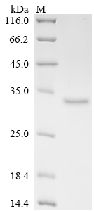 (Tris-Glycine gel) Discontinuous SDS-PAGE (reduced) with 5% enrichment gel and 15% separation gel. (Tris-Glycine gel) Discontinuous SDS-PAGE (reduced) with 5% enrichment gel and 15% separation gel.