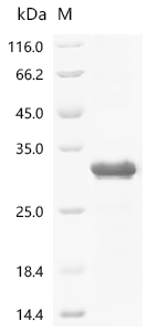 Recombinant Human metapneumovirus Major surface glycoprotein G (G) , partial - image 1