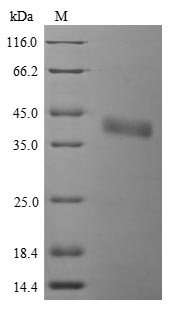 Amazing internalin Recombinant Listeria Monocytogenes Serotype 4b Internalin A Inla Partial Cusabio