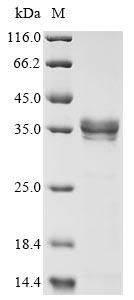 (Tris-Glycine gel) Discontinuous SDS-PAGE (reduced) with 5% enrichment gel and 15% separation gel. (Tris-Glycine gel) Discontinuous SDS-PAGE (reduced) with 5% enrichment gel and 15% separation gel.