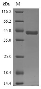 (Tris-Glycine gel) Discontinuous SDS-PAGE (reduced) with 5% enrichment gel and 15% separation gel. (Tris-Glycine gel) Discontinuous SDS-PAGE (reduced) with 5% enrichment gel and 15% separation gel.