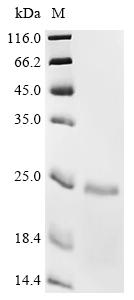 Recombinant Human Telomerase-binding protein EST1A (SMG6) , partial - image 1
