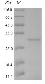 (Tris-Glycine gel) Discontinuous SDS-PAGE (reduced) with 5% enrichment gel and 15% separation gel. (Tris-Glycine gel) Discontinuous SDS-PAGE (reduced) with 5% enrichment gel and 15% separation gel.