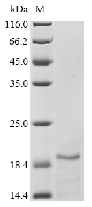 (Tris-Glycine gel) Discontinuous SDS-PAGE (reduced) with 5% enrichment gel and 15% separation gel. (Tris-Glycine gel) Discontinuous SDS-PAGE (reduced) with 5% enrichment gel and 15% separation gel.