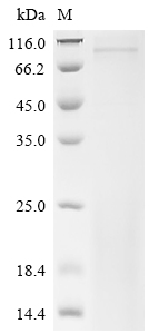Recombinant Mouse Inactive tyrosine-protein kinase 7 (Ptk7) , partial - image 1
