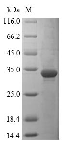 (Tris-Glycine gel) Discontinuous SDS-PAGE (reduced) with 5% enrichment gel and 15% separation gel. (Tris-Glycine gel) Discontinuous SDS-PAGE (reduced) with 5% enrichment gel and 15% separation gel.