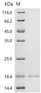 Recombinant Rat Zymogen granule membrane protein 16 (Zg16) - image 1