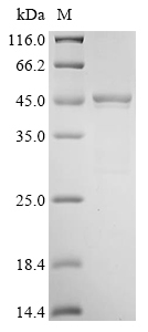 (Tris-Glycine gel) Discontinuous SDS-PAGE (reduced) with 5% enrichment gel and 15% separation gel. (Tris-Glycine gel) Discontinuous SDS-PAGE (reduced) with 5% enrichment gel and 15% separation gel.