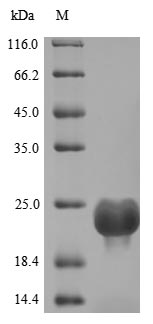(Tris-Glycine gel) Discontinuous SDS-PAGE (reduced) with 5% enrichment gel and 15% separation gel. (Tris-Glycine gel) Discontinuous SDS-PAGE (reduced) with 5% enrichment gel and 15% separation gel.