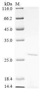(Tris-Glycine gel) Discontinuous SDS-PAGE (reduced) with 5% enrichment gel and 15% separation gel. (Tris-Glycine gel) Discontinuous SDS-PAGE (reduced) with 5% enrichment gel and 15% separation gel.