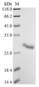 (Tris-Glycine gel) Discontinuous SDS-PAGE (reduced) with 5% enrichment gel and 15% separation gel. (Tris-Glycine gel) Discontinuous SDS-PAGE (reduced) with 5% enrichment gel and 15% separation gel.