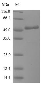 (Tris-Glycine gel) Discontinuous SDS-PAGE (reduced) with 5% enrichment gel and 15% separation gel. (Tris-Glycine gel) Discontinuous SDS-PAGE (reduced) with 5% enrichment gel and 15% separation gel.