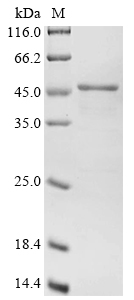 (Tris-Glycine gel) Discontinuous SDS-PAGE (reduced) with 5% enrichment gel and 15% separation gel.