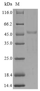 (Tris-Glycine gel) Discontinuous SDS-PAGE (reduced) with 5% enrichment gel and 15% separation gel. (Tris-Glycine gel) Discontinuous SDS-PAGE (reduced) with 5% enrichment gel and 15% separation gel.