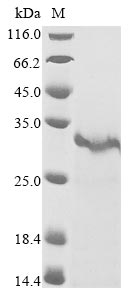Recombinant Crotalus atrox Snake venom serine protease catroxase-2 - image 1