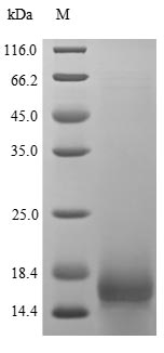 (Tris-Glycine gel) Discontinuous SDS-PAGE (reduced) with 5% enrichment gel and 15% separation gel. (Tris-Glycine gel) Discontinuous SDS-PAGE (reduced) with 5% enrichment gel and 15% separation gel.