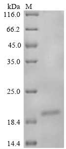 (Tris-Glycine gel) Discontinuous SDS-PAGE (reduced) with 5% enrichment gel and 15% separation gel. (Tris-Glycine gel) Discontinuous SDS-PAGE (reduced) with 5% enrichment gel and 15% separation gel.