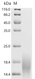 (Tris-Glycine gel) Discontinuous SDS-PAGE (reduced) with 5% enrichment gel and 15% separation gel. (Tris-Glycine gel) Discontinuous SDS-PAGE (reduced) with 5% enrichment gel and 15% separation gel.