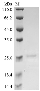 (Tris-Glycine gel) Discontinuous SDS-PAGE (reduced) with 5% enrichment gel and 15% separation gel. (Tris-Glycine gel) Discontinuous SDS-PAGE (reduced) with 5% enrichment gel and 15% separation gel.
