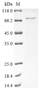 (Tris-Glycine gel) Discontinuous SDS-PAGE (reduced) with 5% enrichment gel and 15% separation gel. (Tris-Glycine gel) Discontinuous SDS-PAGE (reduced) with 5% enrichment gel and 15% separation gel.