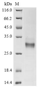 (Tris-Glycine gel) Discontinuous SDS-PAGE (reduced) with 5% enrichment gel and 15% separation gel. (Tris-Glycine gel) Discontinuous SDS-PAGE (reduced) with 5% enrichment gel and 15% separation gel.