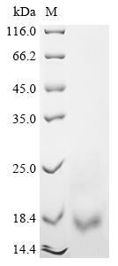 (Tris-Glycine gel) Discontinuous SDS-PAGE (reduced) with 5% enrichment gel and 15% separation gel. (Tris-Glycine gel) Discontinuous SDS-PAGE (reduced) with 5% enrichment gel and 15% separation gel.