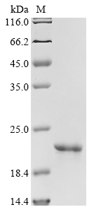 (Tris-Glycine gel) Discontinuous SDS-PAGE (reduced) with 5% enrichment gel and 15% separation gel. (Tris-Glycine gel) Discontinuous SDS-PAGE (reduced) with 5% enrichment gel and 15% separation gel.