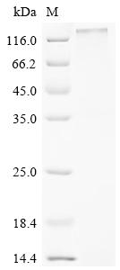 Recombinant Human Seizure 6-like protein (SEZ6L) , partial - image 1