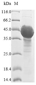 (Tris-Glycine gel) Discontinuous SDS-PAGE (reduced) with 5% enrichment gel and 15% separation gel. (Tris-Glycine gel) Discontinuous SDS-PAGE (reduced) with 5% enrichment gel and 15% separation gel.