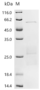 Recombinant Human Ras-related protein Rab-6B (RAB6B) - image 1