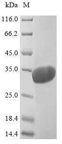 (Tris-Glycine gel) Discontinuous SDS-PAGE (reduced) with 5% enrichment gel and 15% separation gel. (Tris-Glycine gel) Discontinuous SDS-PAGE (reduced) with 5% enrichment gel and 15% separation gel.